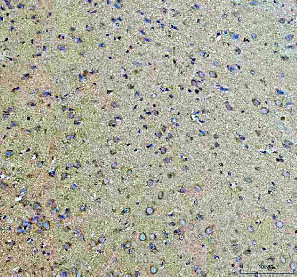 a04191 1 ago3 primary antibodies ihc testing 3_1