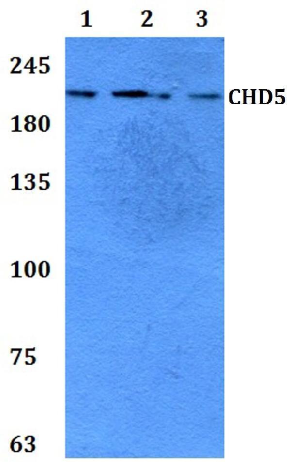 a04192 chd5 primary antiboties wb testing 1