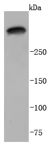 Western blot analysis of Laminnin 5 alpha 3 on A431 cells lysates using anti-Laminnin 5 alpha 3 antibody at 1/1,000 dilution