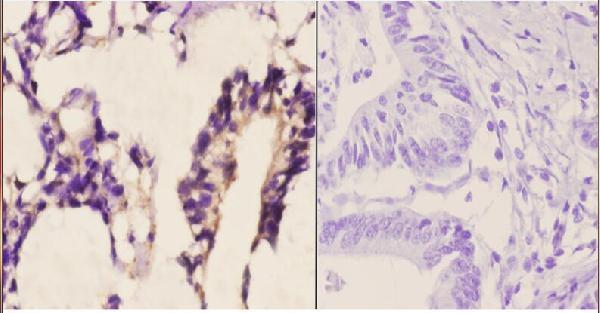 a04196 1 tacc1 primary antiboties ihc testing 2