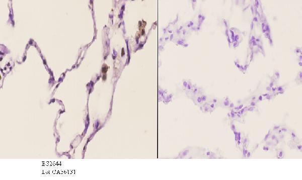 a04196 1 tacc1 primary antiboties ihc testing 3