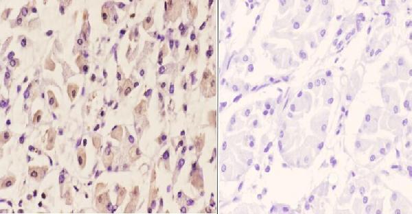 a04196 1 tacc1 primary antiboties ihc testing 4