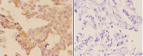 a04197 1 adcy5 primary antiboties ihc testing 2