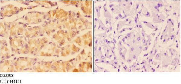 a04197 1 adcy5 primary antiboties ihc testing 3