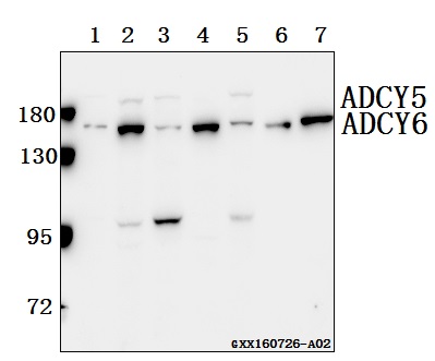 a04197 1 adcy5 primary antiboties wb testing 1