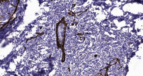 a04197 adcy5 primary antibodies ihc testing 1