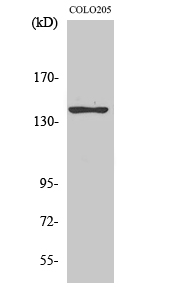 a04197 adcy5 primary antibodies wb testing 2