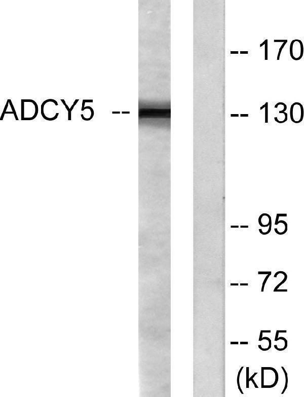 a04197 adcy5 primary antibodies wb testing 3