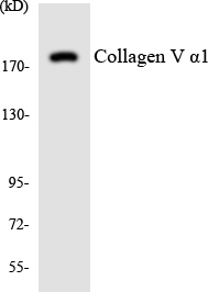 a04197 adcy5 primary antibodies wb testing 4