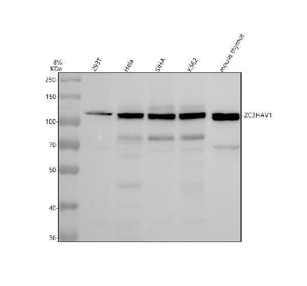 Western blot analysis of ZC3HAV1 using anti-ZC3HAV1 antibody (A04199-1)