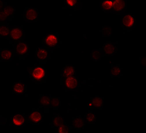 a04199 zc3hav1 primary antibodies if testing 3
