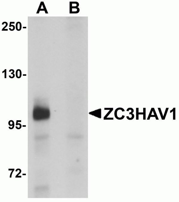 Western blot analysis of ZC3HAV1 in HeLa cell lysate with ZC3HAV1 antibody at 1μg/mL in (A) the absence and (B) the presence of blocking peptide