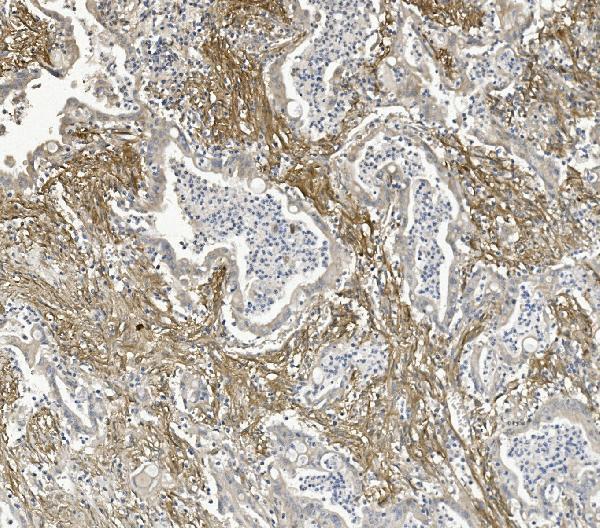 a04201 1 itgb5 primary antibodies ihc testing 2