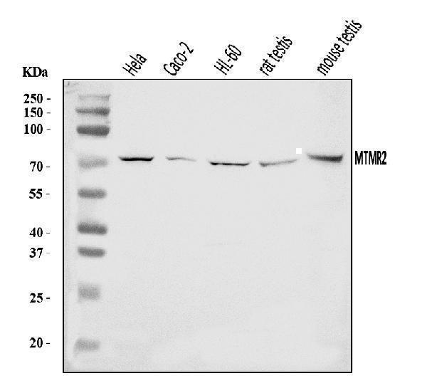  Western blot analysis of MTMR2 using anti-MTMR2 antibody (A04202-1)