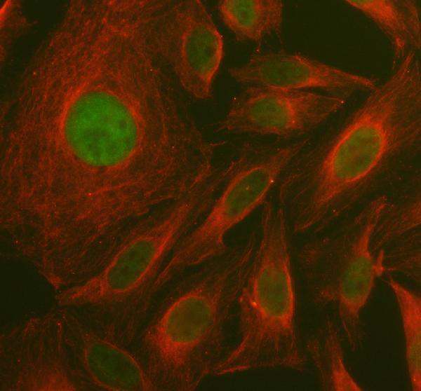 IF analysis of MAT1A using anti-MAT1A antibody (A04203-1) and anti-Alpha Tubulin antibody (M03989-3)