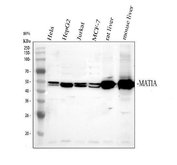 Western blot analysis of MAT1A using anti-MAT1A antibody (A04203-1)