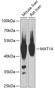 Western blot analysis of extracts of various cell lines, using MAT1A antibody  at 1:1000 dilution
