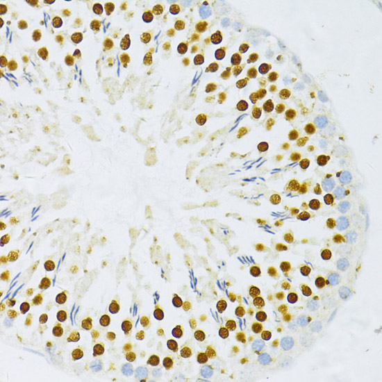 Immunohistochemistry of paraffin-embedded rat testis using TFDP1 antibody