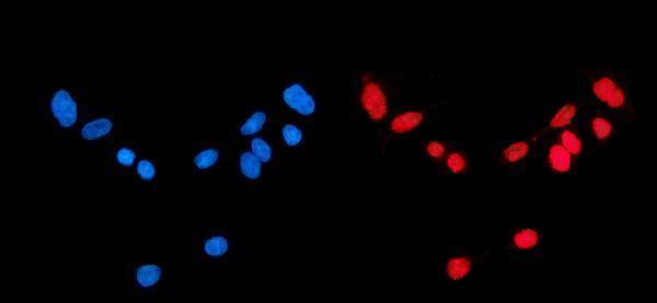 a04206 2 cbx1 primary antibodies if testing 6