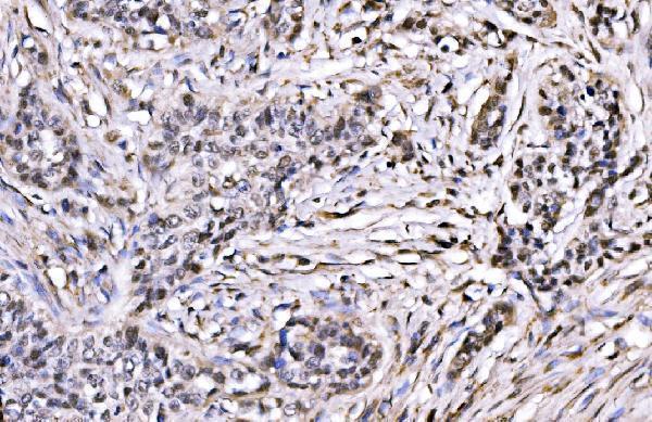  IHC analysis of CBX1/HP1 beta using anti-CBX1/HP1 beta antibody (A04206-2)