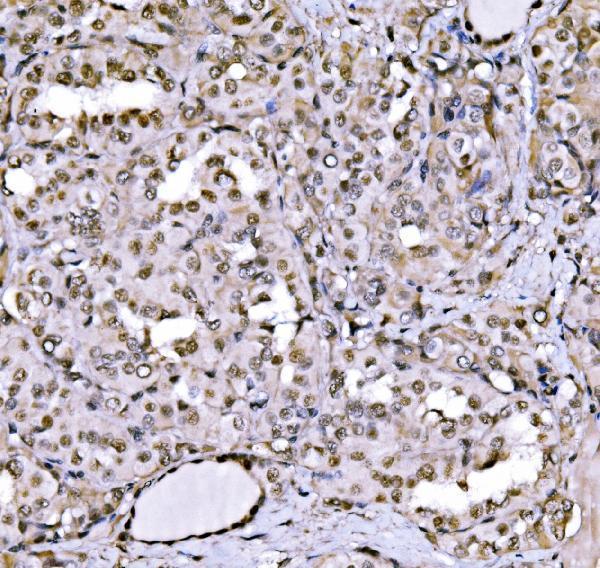 a04206 2 cbx1 primary antibodies ihc testing 3