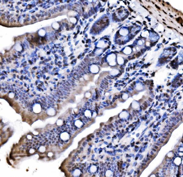 a04206 2 cbx1 primary antibodies ihc testing 4