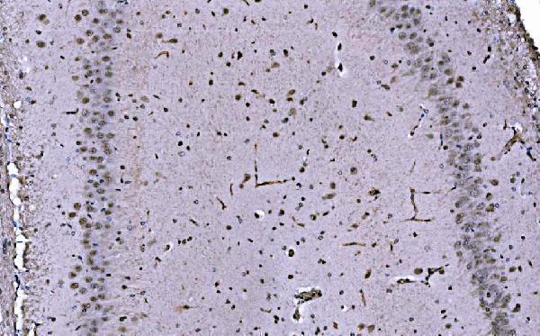 a04206 2 cbx1 primary antibodies ihc testing 5