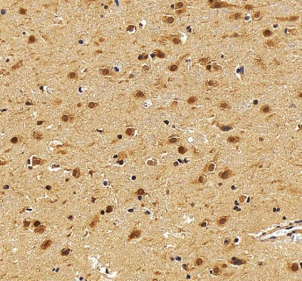IHC analysis of CBX1 using anti-CBX1 antibody (A04206-2)