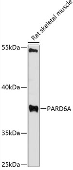 a04207 pard6a primary antiboties wb testing 1