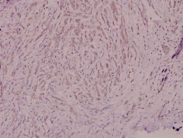 a04208 ncf4 primary antiboties ihc testing 2