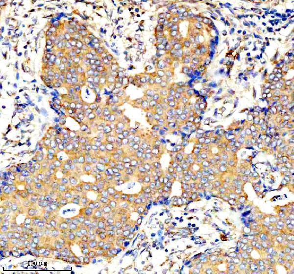  IHC analysis of AMPD1 using anti-AMPD1 antibody (A04209-1)