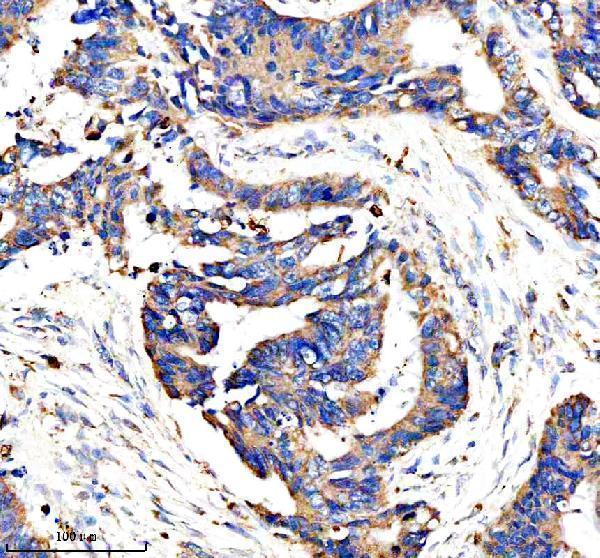  IHC analysis of AMPD1 using anti-AMPD1 antibody (A04209-1)