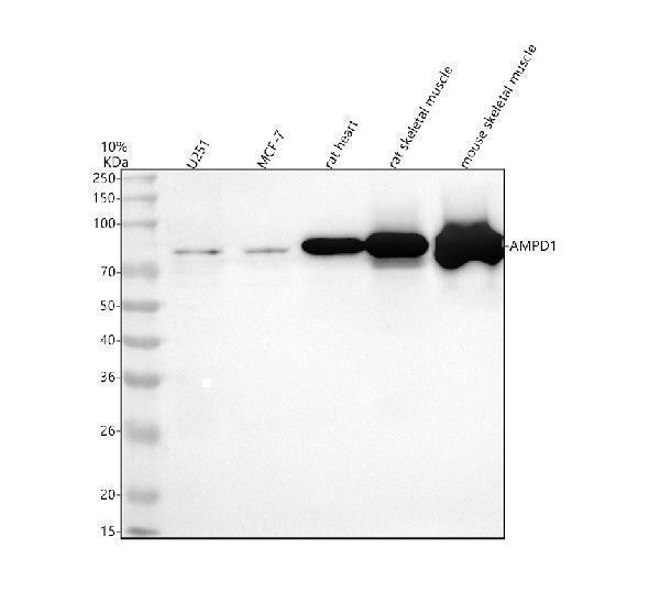  Western blot analysis of AMPD1 using anti-AMPD1 antibody (A04209-1)