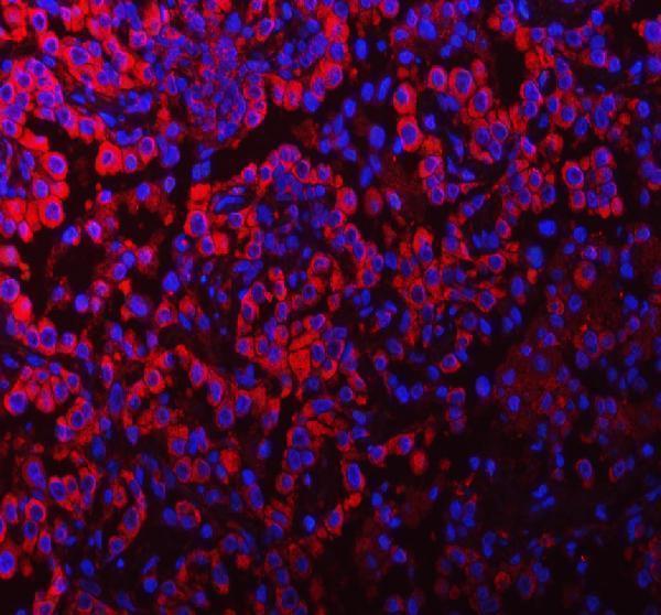 a04211 2 pacsin2 primary antibodies if testing 7