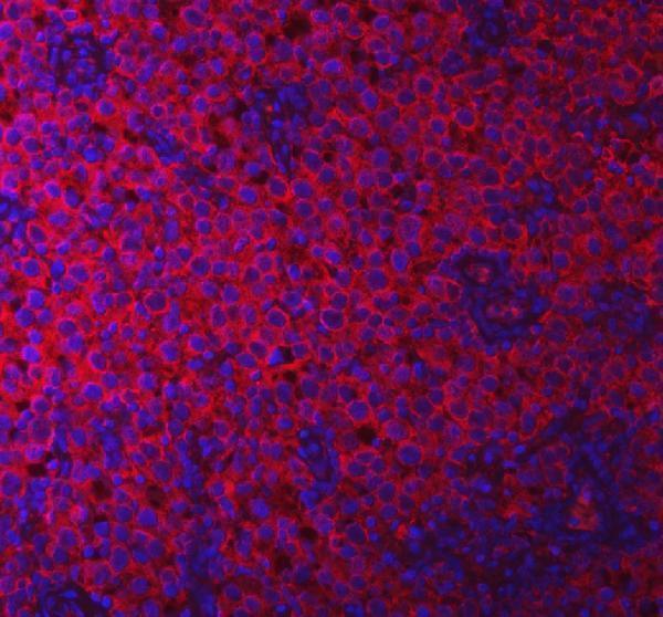 a04211 2 pacsin2 primary antibodies if testing 8