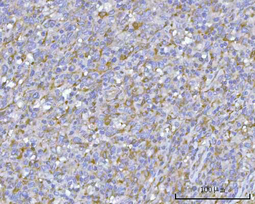 IHC analysis of PACSIN2 using anti-PACSIN2 antibody (A04211-2)