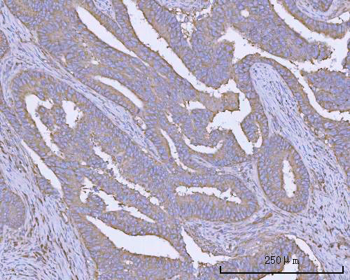  IHC analysis of PACSIN2 using anti-PACSIN2 antibody (A04211-2)