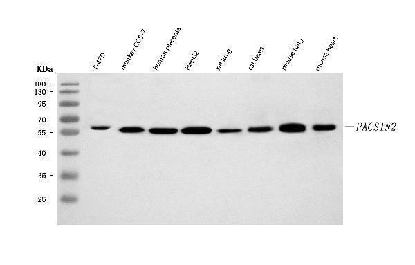  Western blot analysis of PACSIN2 using anti-PACSIN2 antibody (A04211-2)