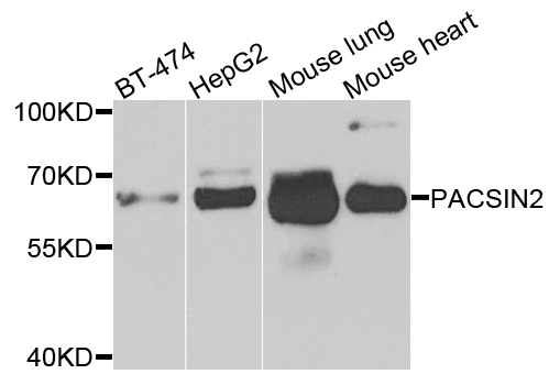 a04211 anti pacsin2 antibody wb testing 1
