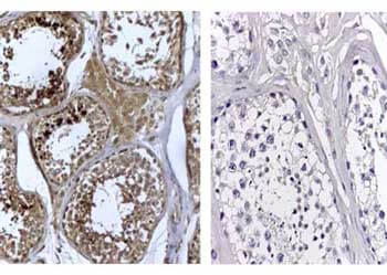 a04214 dnmt3l primary antibodies ihc testing 1