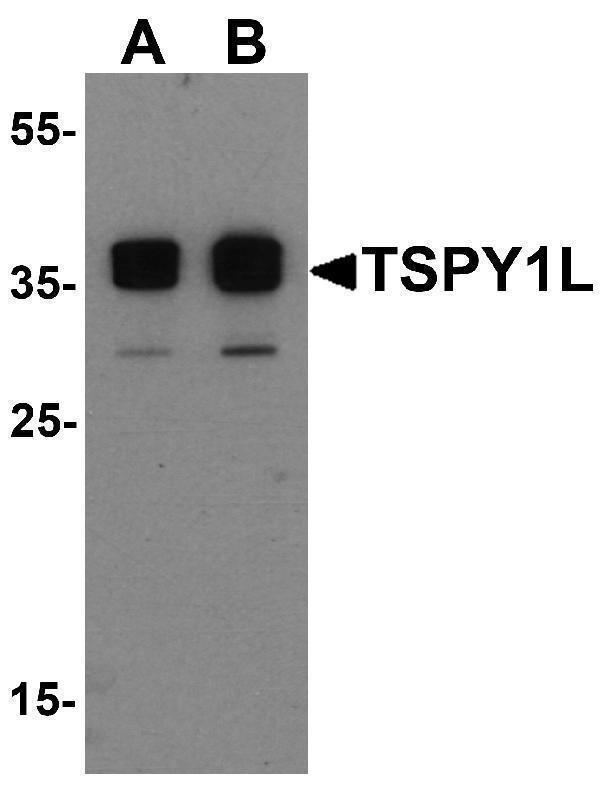 Western blot analysis of TSPY1L in A20 cell lysate with TSPY1L antibody at (A) 0