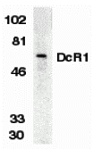 Western blot analysis of DcR1 in HeLa whole cell lysate with DcR1 antibody (ED) at 1:500 dilution