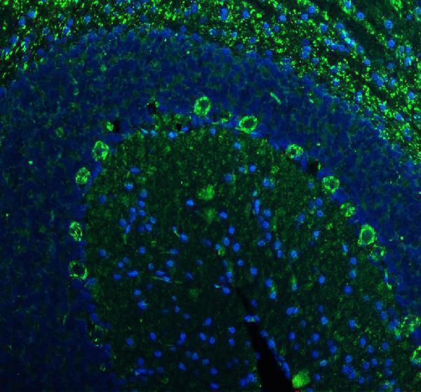 a04219 2 ywhah primary antibodies if testing 1