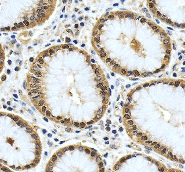 IHC analysis of YWHAH using anti-YWHAH antibody (A04219-2)