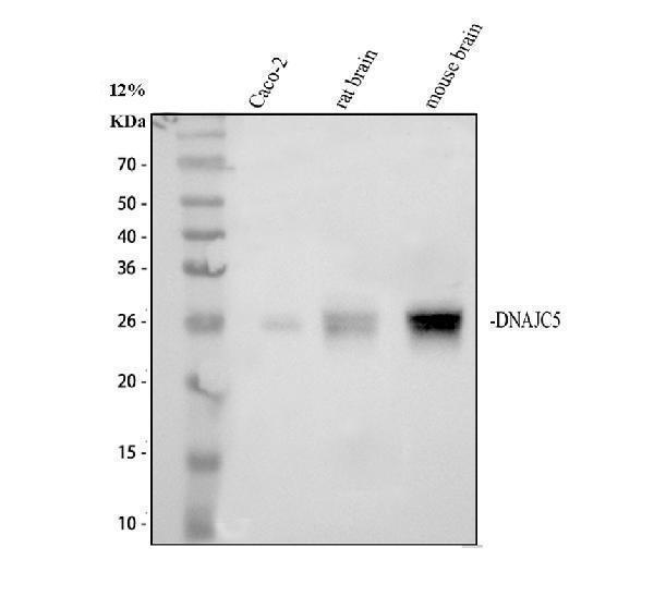 Western blot analysis of DNAJC5 using anti-DNAJC5 antibody (A04220-2)