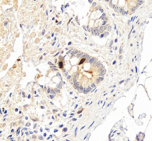 a04223 1 pyy primary antibodies ihc testing 2_1