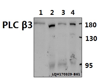 Western blot (WB) analysis of PLC β3 (D1099) polyclonal antibody at 1:500 dilution
Lane1:CT-26 whole cell lysate(40ug)
Lane2:PC12 whole cell lysate(40ug)
Lane3:HEK293T whole cell lysate(40ug)
Lane4:Hela whole cell lysate(40ug)