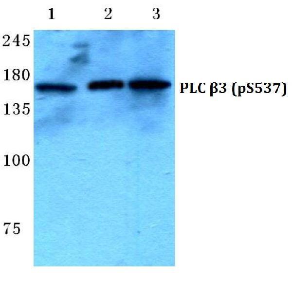 Western blot (WB) analysis of p-PLC β3 (S537) polyclonal antibody at 1:500 dilution
Lane1:MCF-7 cell lysate treated with UV
Lane2:Mouse brain tissue lysate
Lane3:Rat brain tissue lysate