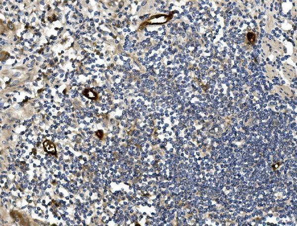  IHC analysis of MAdCAM14 using anti-MAdCAM1 antibody (A04227-2)