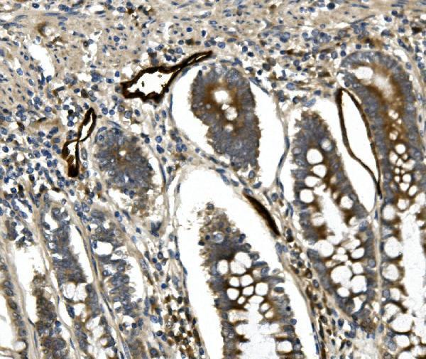  IHC analysis of MAdCAM14 using anti-MAdCAM1 antibody (A04227-2)